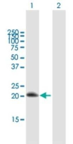 RGS10 Antibody, Novus Biologicals 0.05 mg | Buy Online | Novus Biologicals | Fisher Scientific