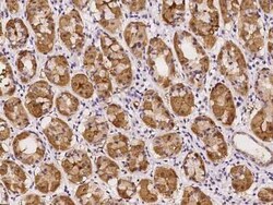 RGS11 Antibody, Novus Biologicals 50 &mu;g, Unconjugated:Antibodies, Polyclonal