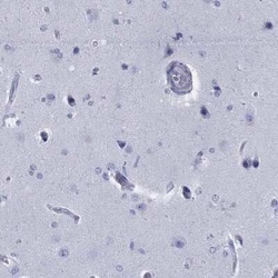 RGS13 Rabbit anti-Human, Polyclonal, Novus Biologicals 25 &mu;g; Unconjugated:Antibodies,