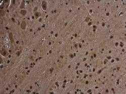 RGS14 Antibody, Novus Biologicals 100 μg; Unconjugated:Antibodies, Polyclonal
