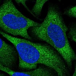 RGS16 Antibody, Novus Biologicals 25 &mu;L, Unconjugated:Antibodies, Polyclonal