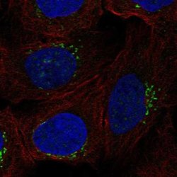 RGS18 Antibody, Novus Biologicals RGS18 Antibody; Unconjugated; 100 &mu;L:Antibodies,