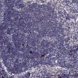 RGS19 Antibody, Novus Biologicals:Antibodies:Primary Antibodies