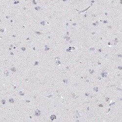 RGS19 Antibody, Novus Biologicals:Antibodies:Primary Antibodies