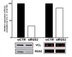 RGS2 Antibody (4C4), Novus Biologicals 0.1 mg, Unconjugated:Antibodies,