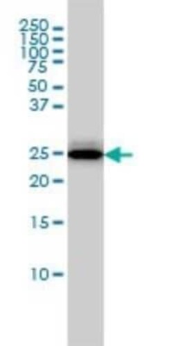 RGS2 Antibody (4C4), Novus Biologicals 0.1 mg, Unconjugated:Antibodies,