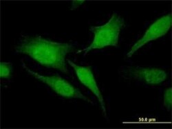 RGS20 Antibody (3E10), Novus Biologicals 0.1 mg | Buy Online | Novus Biologicals | Fisher Scientific