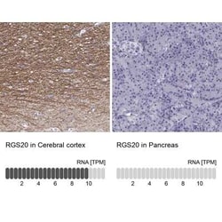 RGS20 Antibody, Novus Biologicals:Antibodies:Primary Antibodies