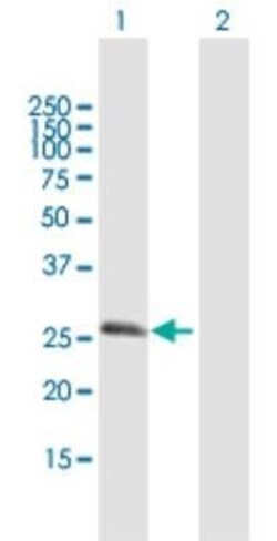 RGS20 Antibody, Novus Biologicals 0.05 mg | Buy Online | Novus Biologicals | Fisher Scientific
