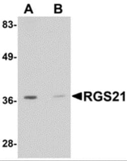 RGS21 Antibody - BSA Free, Novus Biologicals 0.1 mg; Unconjugated:Antibodies,