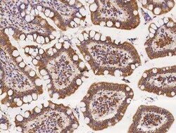 RGS6 Antibody, Novus Biologicals 50 &mu;g; Unconjugated:Antibodies, Polyclonal