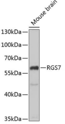 RGS7 Antibody - BSA Free, Novus Biologicals 0.02 mL; Unconjugated:Antibodies,