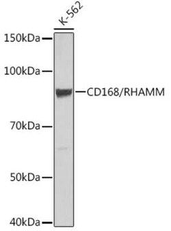 RHAMM/CD168 Rabbit anti-Human, Mouse, Clone: 3L10H9, Novus Biologicals 20 &mu;g | Buy Online | Bio-Techne | Fisher Scientific