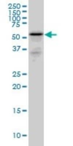 RHCG Antibody (5A4), Novus Biologicals 0.1 mg | Buy Online | Novus Biologicals | Fisher Scientific