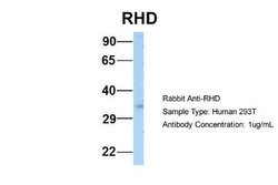 RHD Rabbit anti-Human, Polyclonal, Novus Biologicals 0.1ml; Unconjugated:Antibodies,
