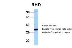 RHD Rabbit anti-Human, Polyclonal, Novus Biologicals 0.1ml; Unconjugated:Antibodies,