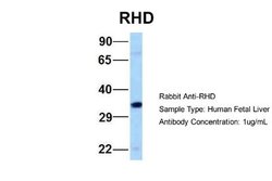 RHD Rabbit anti-Human, Polyclonal, Novus Biologicals 0.1ml; Unconjugated:Antibodies,