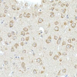 RHOT2 Antibody - Azide and BSA Free, Novus Biologicals:Antibodies:Primary