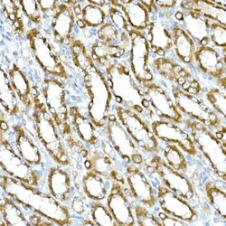 RHOT2 Antibody - Azide and BSA Free, Novus Biologicals:Antibodies:Primary
