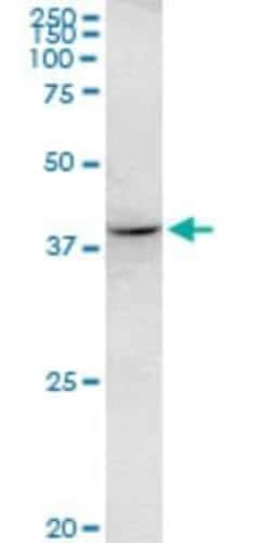 RHOXF2 Antibody (3C4), Novus Biologicals 0.1 mg | Buy Online | Novus Biologicals | Fisher Scientific
