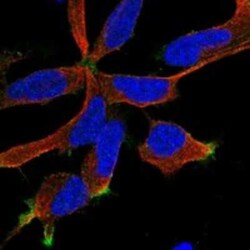 RIC8B Rabbit anti-Human, Polyclonal, Novus Biologicals 100 &mu;g | Buy Online | Novus Biologicals | Fisher Scientific