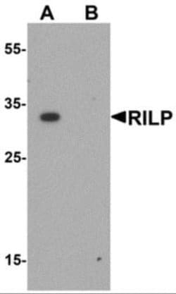 RILP Antibody - BSA Free, Novus Biologicals 0.1 mg; Unconjugated:Antibodies,