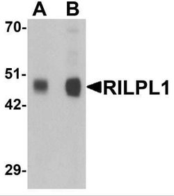 RILPL1 Antibody - BSA Free, Novus Biologicals 0.1 mg | Buy Online | Novus Biologicals | Fisher Scientific