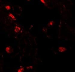 RILPL2 Antibody - BSA Free, Novus Biologicals 0.1 mg | Buy Online | Novus Biologicals | Fisher Scientific