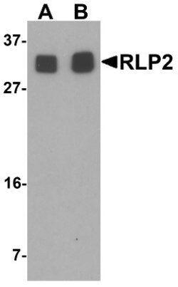 RILPL2 Antibody - BSA Free, Novus Biologicals 0.1 mg | Buy Online | Novus Biologicals | Fisher Scientific
