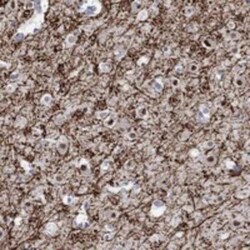 RIMS1 Rabbit anti-Human, Polyclonal, Novus Biologicals 25 &mu;g; Unconjugated:Antibodies,