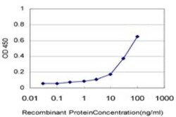 Novus Biologicals RIN2 Antibody (1E7), Novus Biologicals 0.1 mg | Buy Online | Novus Biologicals&trade; | Fisher Scientific