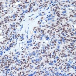 RING1 Rabbit anti-Human, Clone: 2Q8D5, Novus Biologicals:Antibodies:Primary