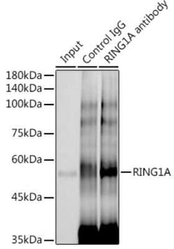 RING1 Rabbit anti-Human, Clone: 2Q8D5, Novus Biologicals:Antibodies:Primary