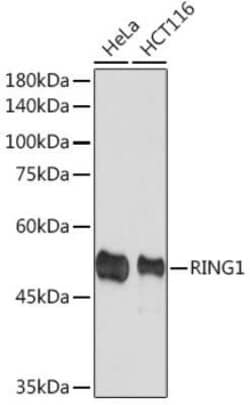RING1 Rabbit anti-Human, Clone: 2Q8D5, Novus Biologicals:Antibodies:Primary