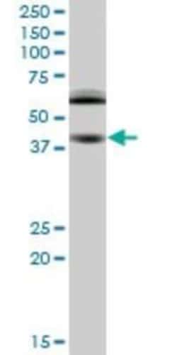 Novus Biologicals RING1 Antibody (2B3), Novus Biologicals 0.1 mg | Buy Online | Novus Biologicals&trade; | Fisher Scientific