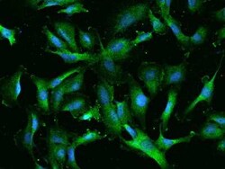 RIOK2 Antibody, Novus Biologicals 100 &mu;g, Unconjugated:Antibodies, Polyclonal