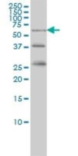 RIOK3 Antibody (3G11), Novus Biologicals 0.1 mg | Buy Online | Novus Biologicals | Fisher Scientific
