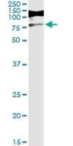 RIOK3 Antibody (4A12-1D2), Novus Biologicals 0.1 mg | Buy Online | Novus Biologicals | Fisher Scientific