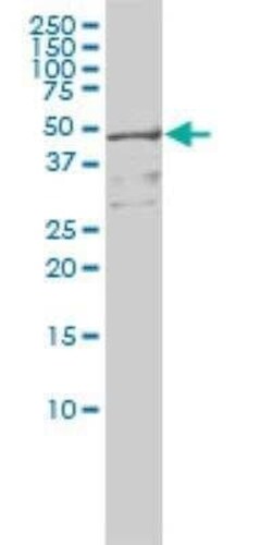 RIOK3 Antibody (4A12-1D2), Novus Biologicals 0.1 mg | Buy Online | Novus Biologicals | Fisher Scientific