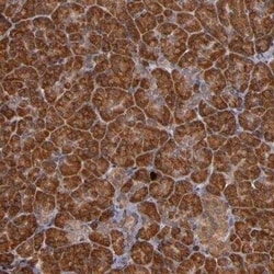 RIOK3 Antibody, Novus Biologicals 25 &mu;L | Buy Online | Novus Biologicals | Fisher Scientific