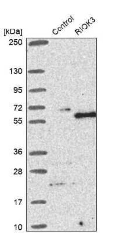 RIOK3 Antibody, Novus Biologicals 25 &mu;L | Buy Online | Novus Biologicals | Fisher Scientific