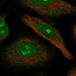 RIP140 Rabbit anti-Human, Polyclonal, Novus Biologicals 100 &mu;g; Unconjugated:Antibodies,