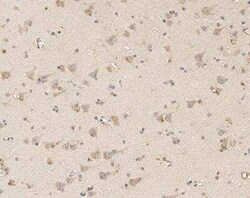 RIP5 Antibody, Novus Biologicals:Antibodies:Primary Antibodies