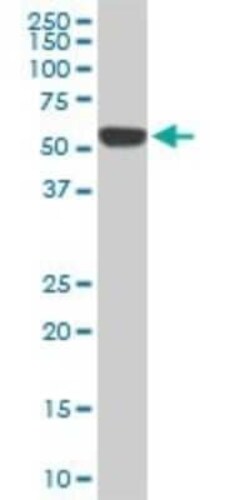 RIPK2 Antibody (2C7), Novus Biologicals 0.1 mg | Buy Online | Novus Biologicals | Fisher Scientific