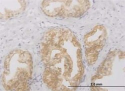 RIPK2 Antibody (6F7), Novus Biologicals 0.1 mg | Buy Online | Novus Biologicals | Fisher Scientific