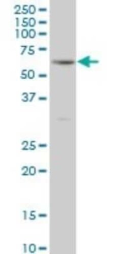 RIPK2 Antibody (6F7), Novus Biologicals 0.1 mg | Buy Online | Novus Biologicals | Fisher Scientific