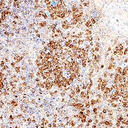 Human RIPK2/RIP2 Antibody, R D Systems 25 &mu;g; Unconjugated:Antibodies,