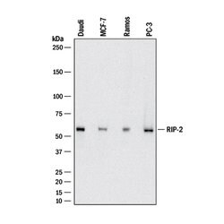 Human RIPK2/RIP2 Antibody, R D Systems 25 &mu;g; Unconjugated:Antibodies,