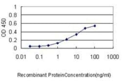 RIPK4 Antibody (2G3), Novus Biologicals 0.1 mg | Buy Online | Novus Biologicals | Fisher Scientific