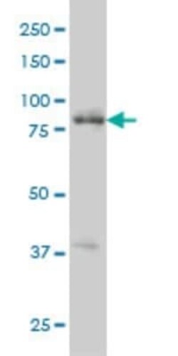 RIPK4 Antibody (2G3), Novus Biologicals 0.1 mg | Buy Online | Novus Biologicals | Fisher Scientific